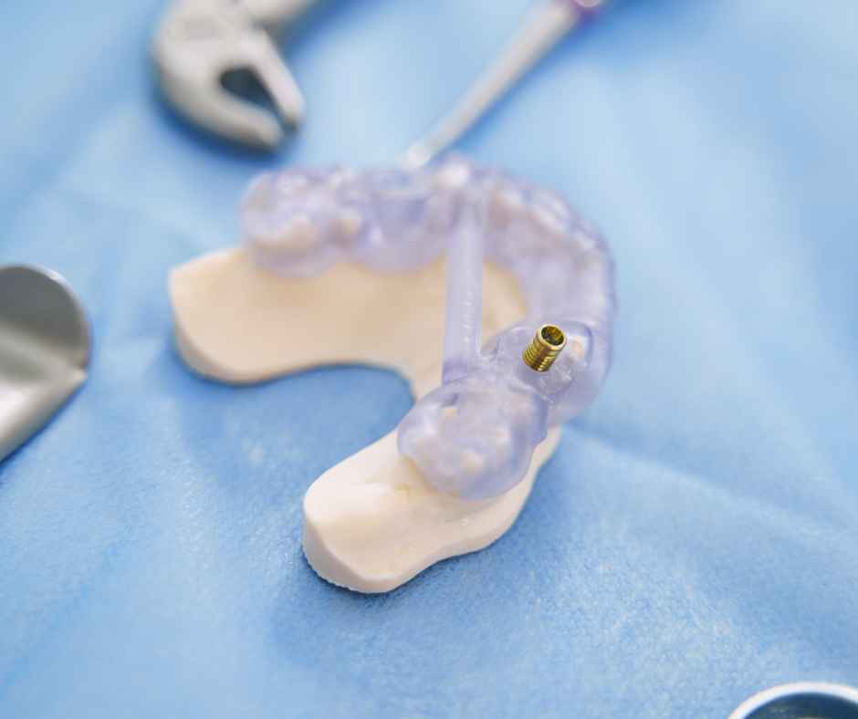 Dental implant placement procedure