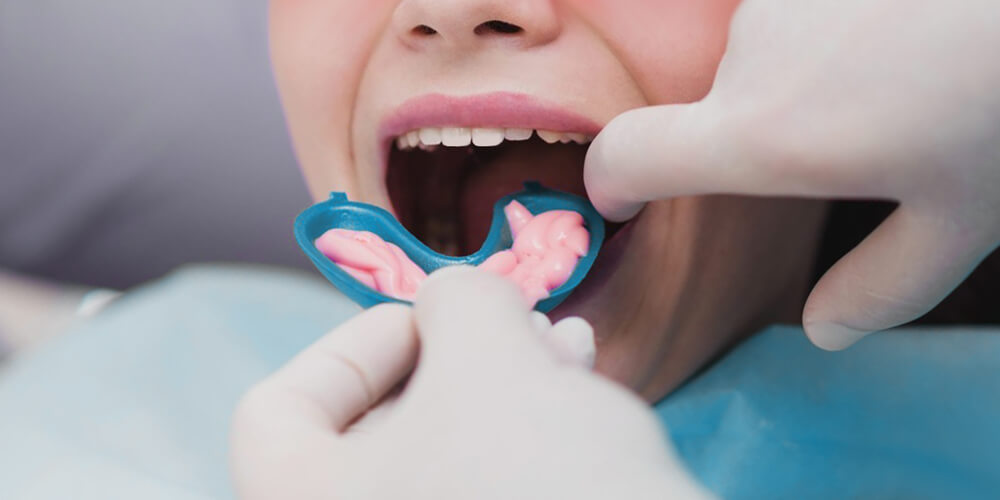 Fluoride Treatment London